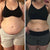 Resultados visibles de reducción de abdomen y medidas con Redu Sculpt